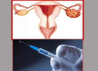ग्रामीण भेगका महिलामा पाठेघरको समस्या अधिक
